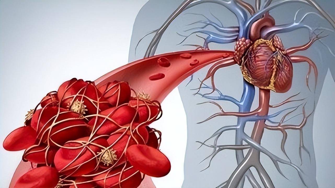 心肌病是个什么病?对身体有哪些危害?如何治疗与管理?