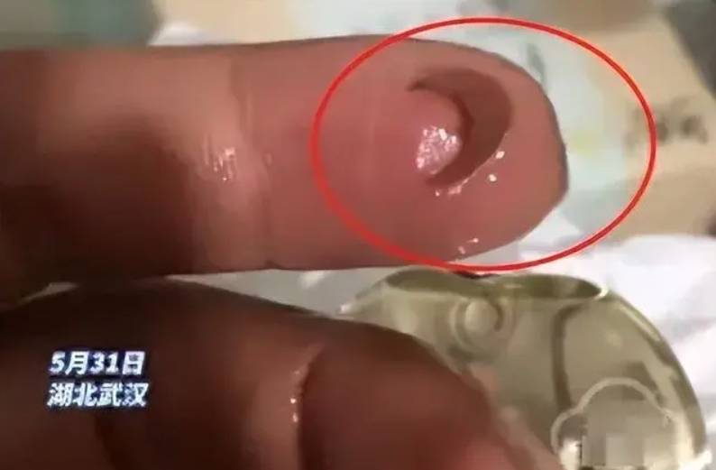 八宝粥里吃到疑似指甲壳异物 娃哈哈半年三曝食