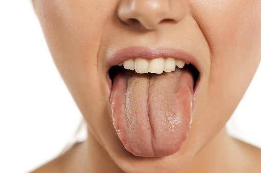 舌头是健康"晴雨表"?当出现这4种变化,可能是身体在"求救"