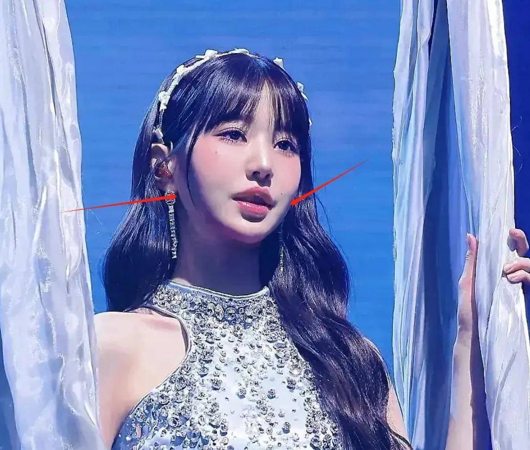 韩星林娜琏脸部肿胀变气球,韩式审美太糟糕,大批偶像