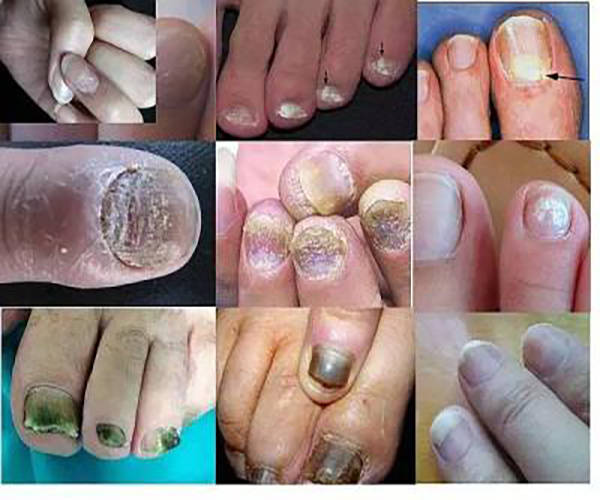 试试这3招,每天成本只要几毛钱!