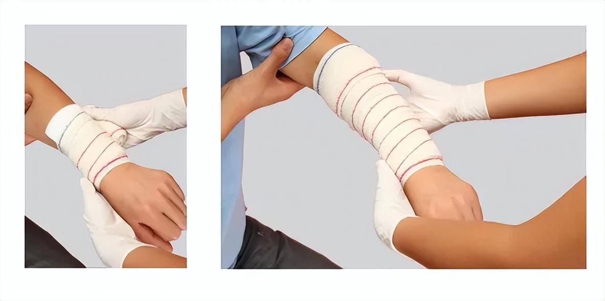 绷带如何包扎