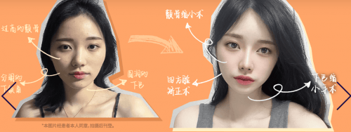 view:韩国面部轮廓手术如何降低风险