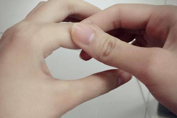 一到秋天,手上莫名长出"小水泡",奇痒难耐,和哪些原因有关?