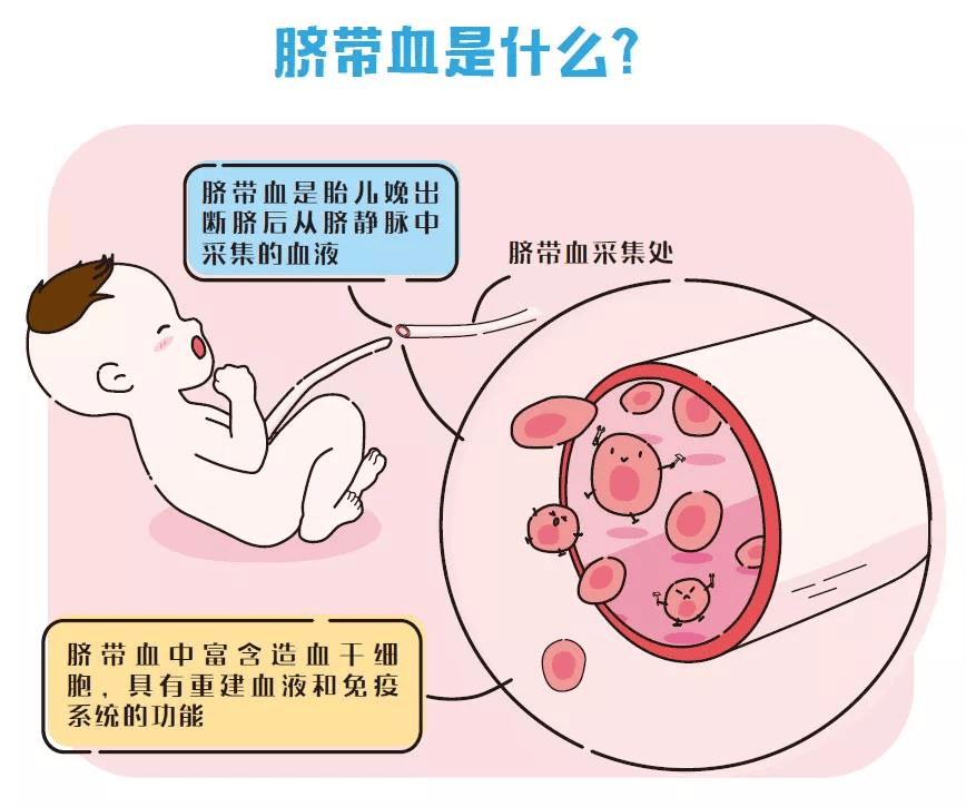 脐血是胎儿娩出断脐后从脐静脉中采集的血液,富含造血干细胞,具有重建