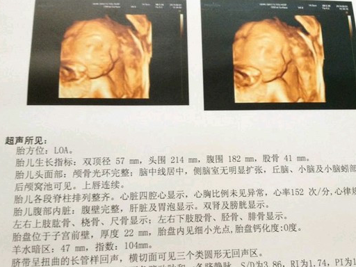 检查_胎儿_小宝宝