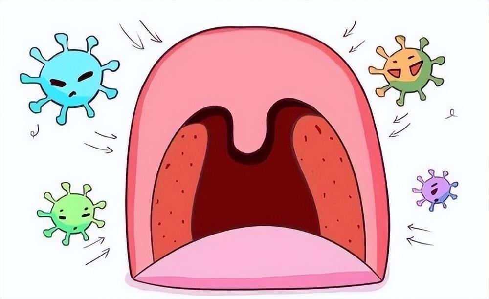 经常扁桃体发炎怎么办?这些原因都易引起发炎!出现症状及时就医