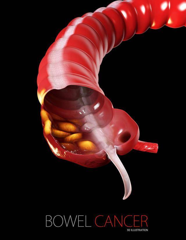 一直憋着不拉屎,第几天会死?提醒:中老年人憋屎有五个危害