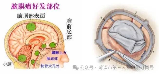 枕骨大孔矢状位解剖图图片