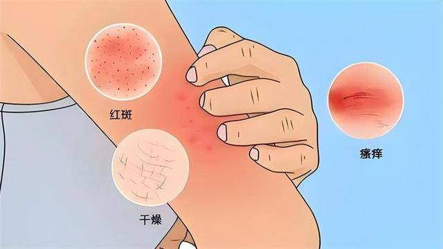 人若感染艾滋病,"潜伏期"是多久?提醒:不要与皮肤病混为一谈