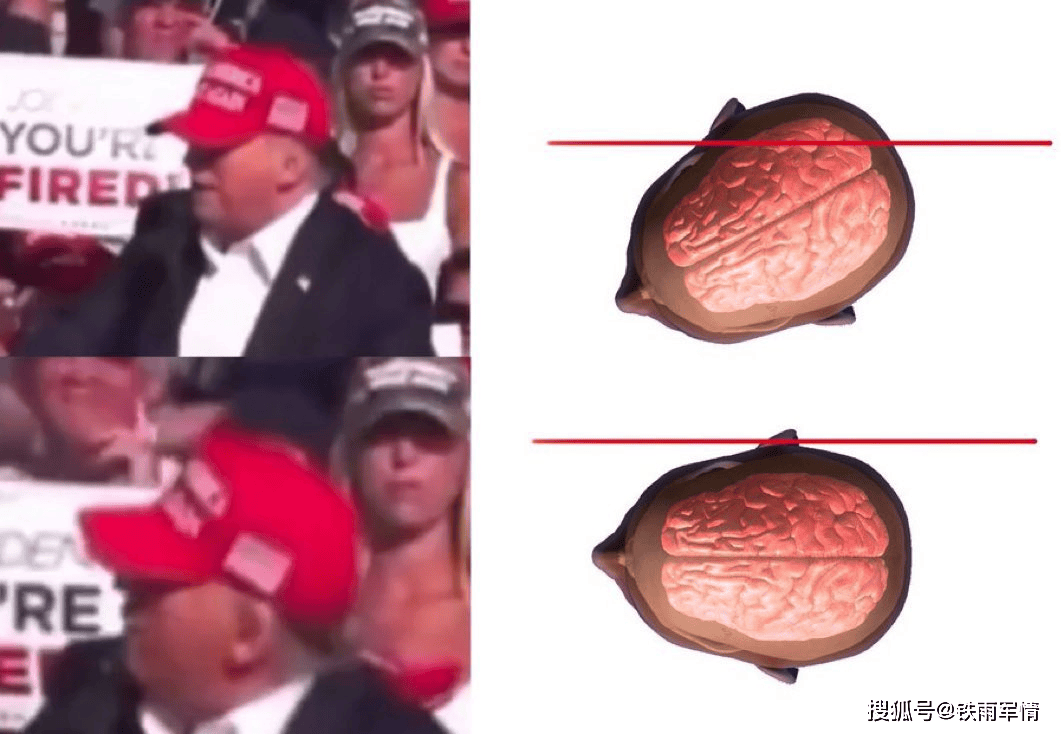 凶手明显是照着特朗普的头部开枪的,只是因为距离和特朗普突然动了一