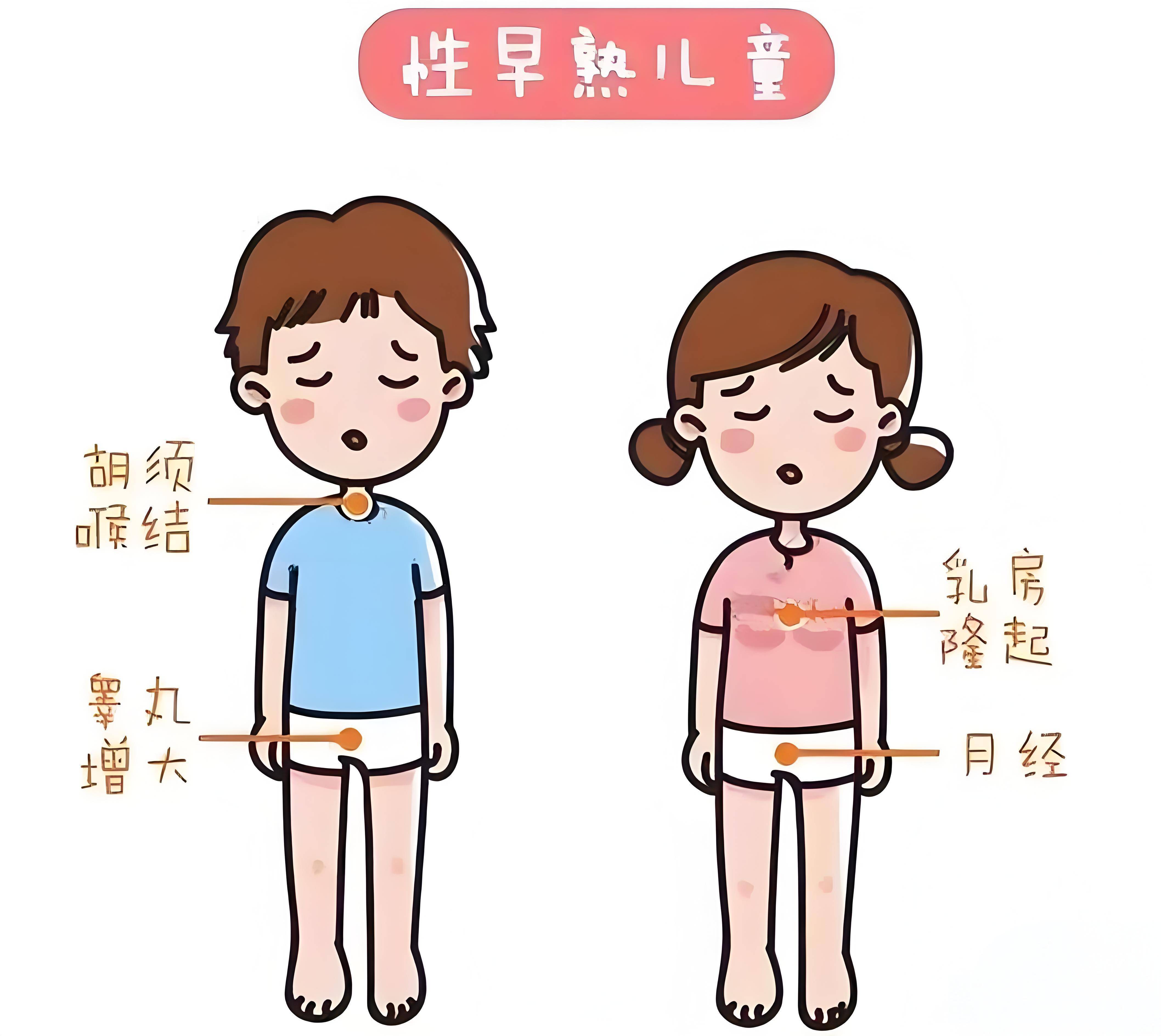儿童性早熟:家长关心的那些问题,看薛红欣医生如何专业解答