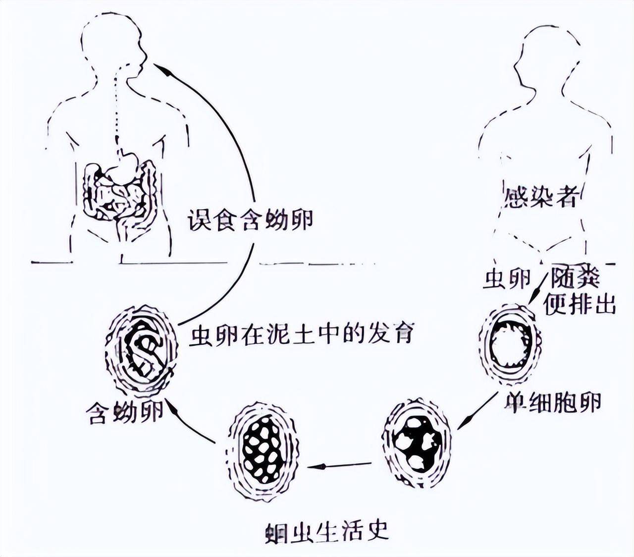 腹の中の寄生虫图片