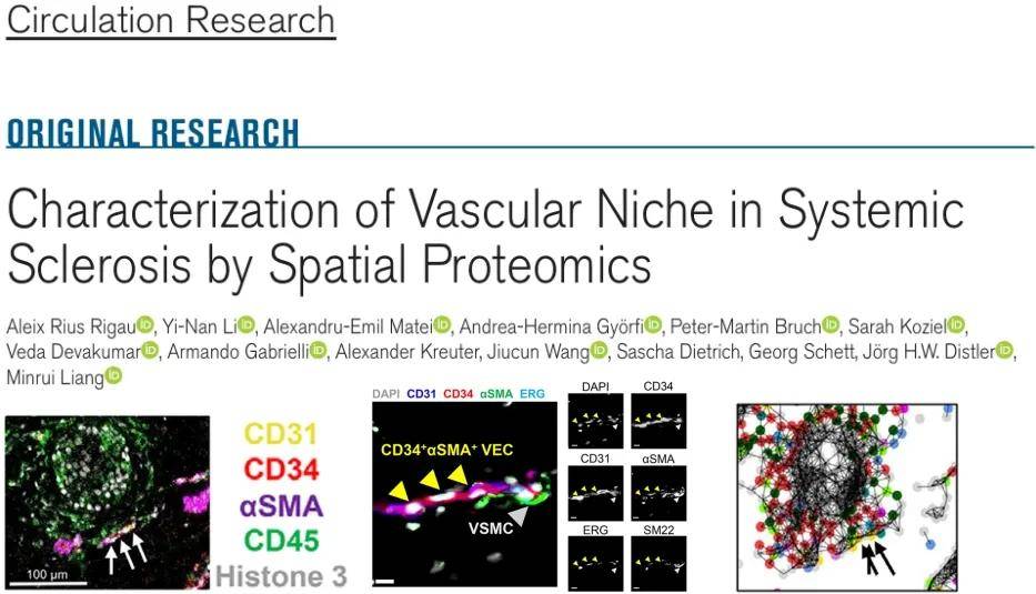 Nature | 重庆大学印明柱团队在单细胞尺度下解析肿瘤血管生成及互作微环境_研究_分析_CapECs