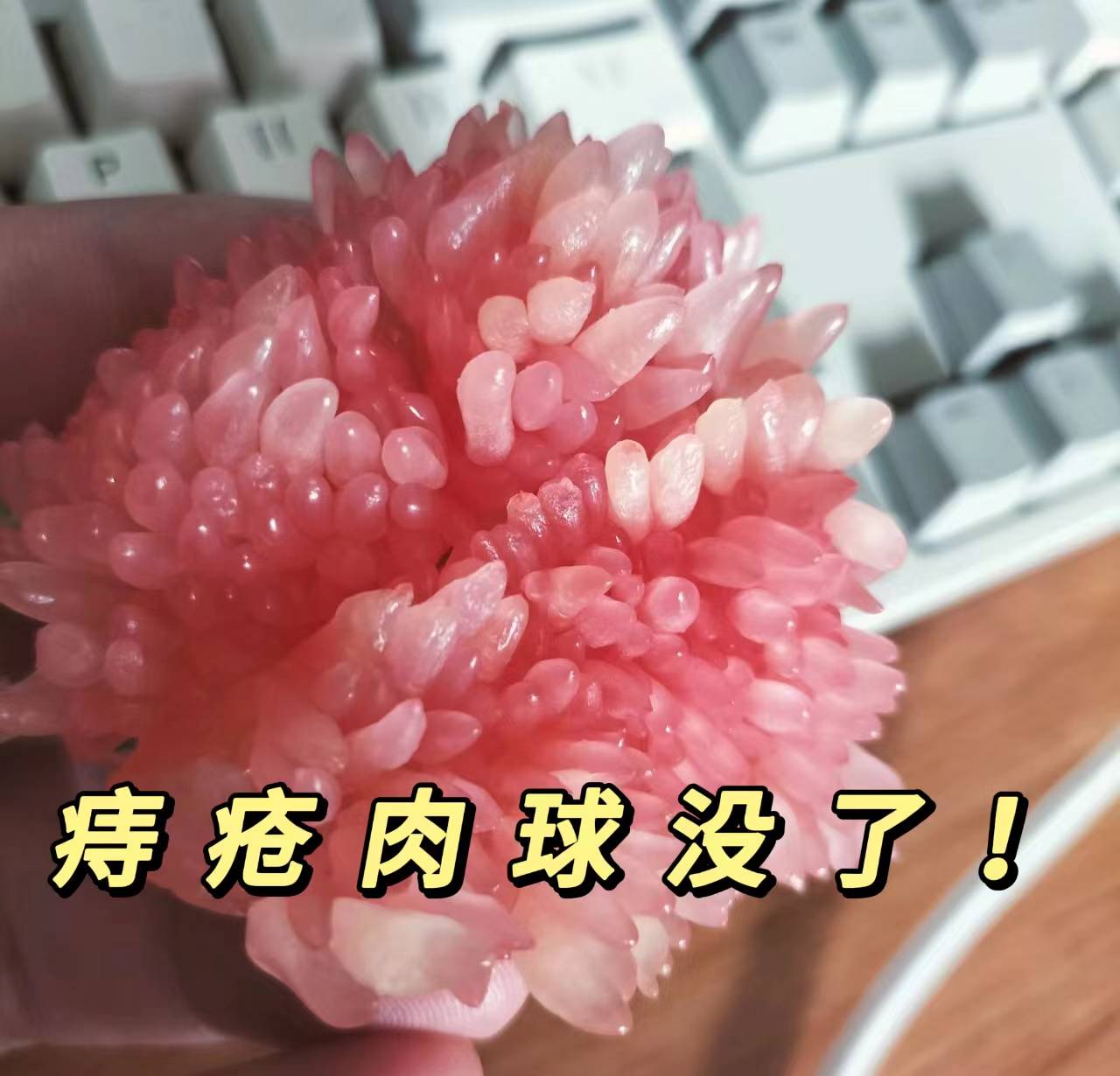 痔疮干瘪照片图片