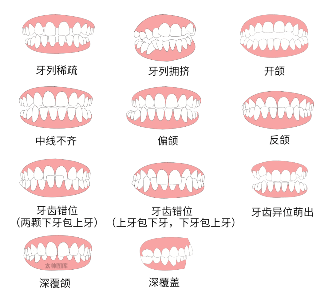 牙齿种类位置图图片