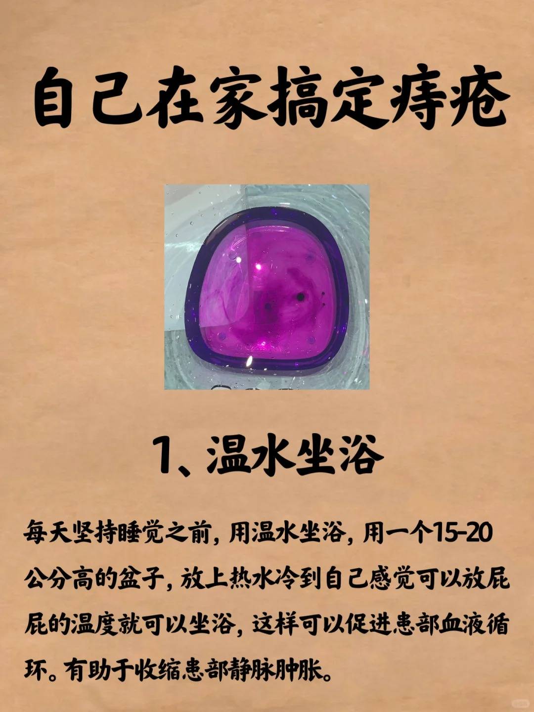 快来看看你的痔疮属于哪一类?