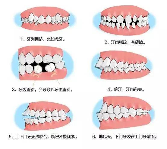 上齿背下齿背位置图图片