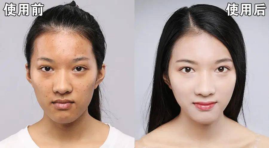祛斑效果最好的排名第一,哪些产品效果拔群?