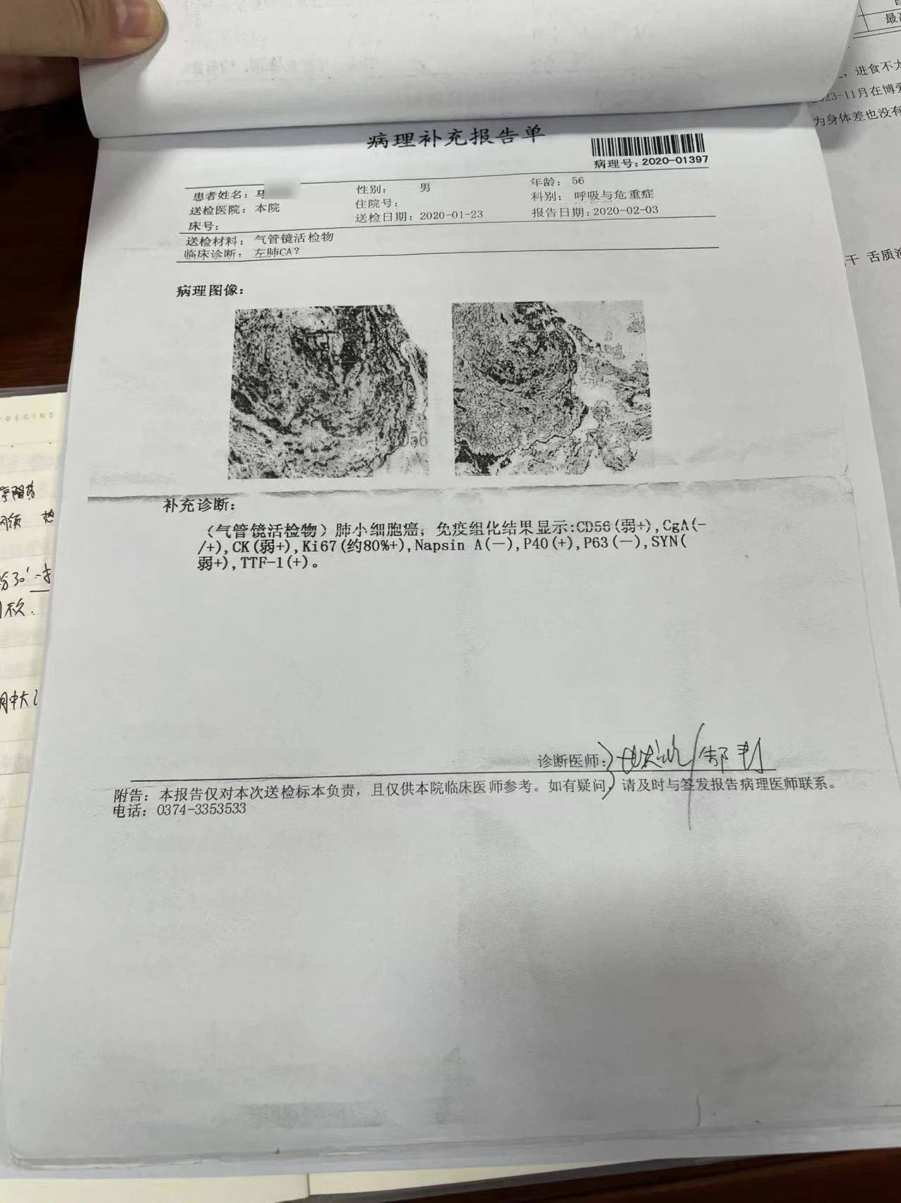 肺癌患者四年抗争路,医生赞叹控制成效非凡