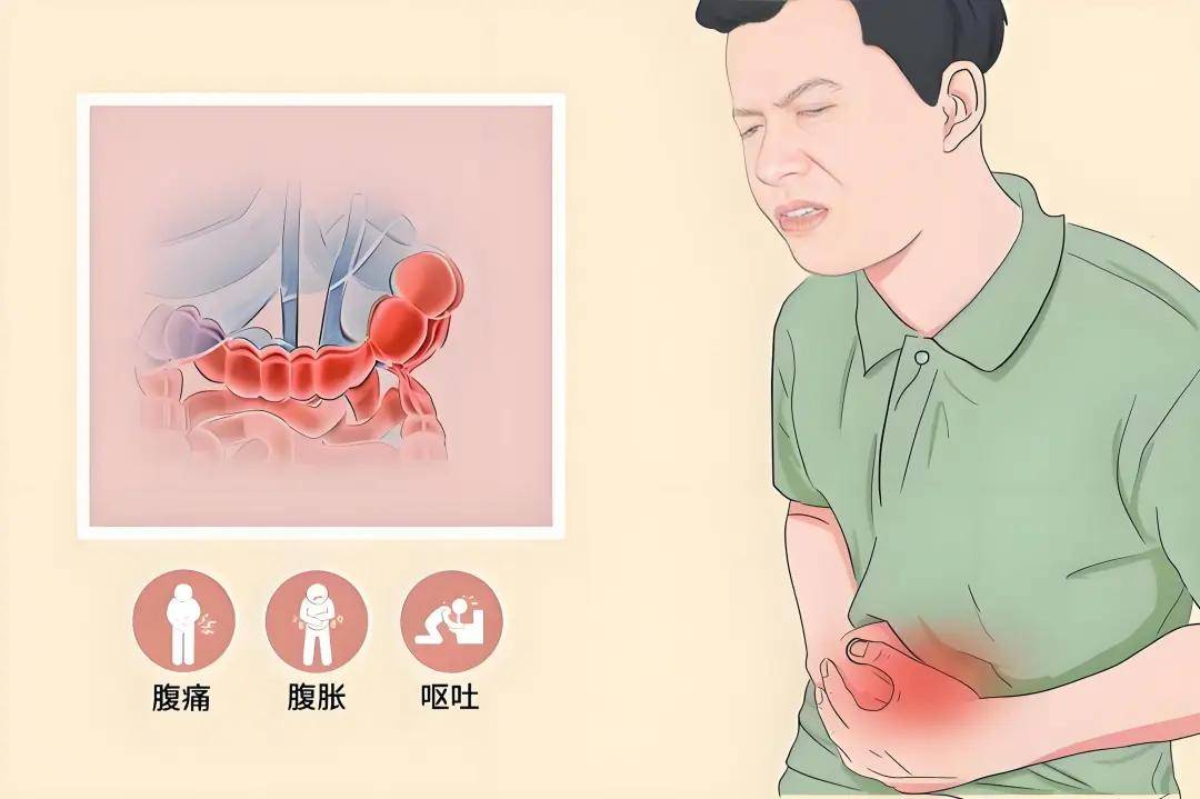 肠痉挛疼痛的位置图图片