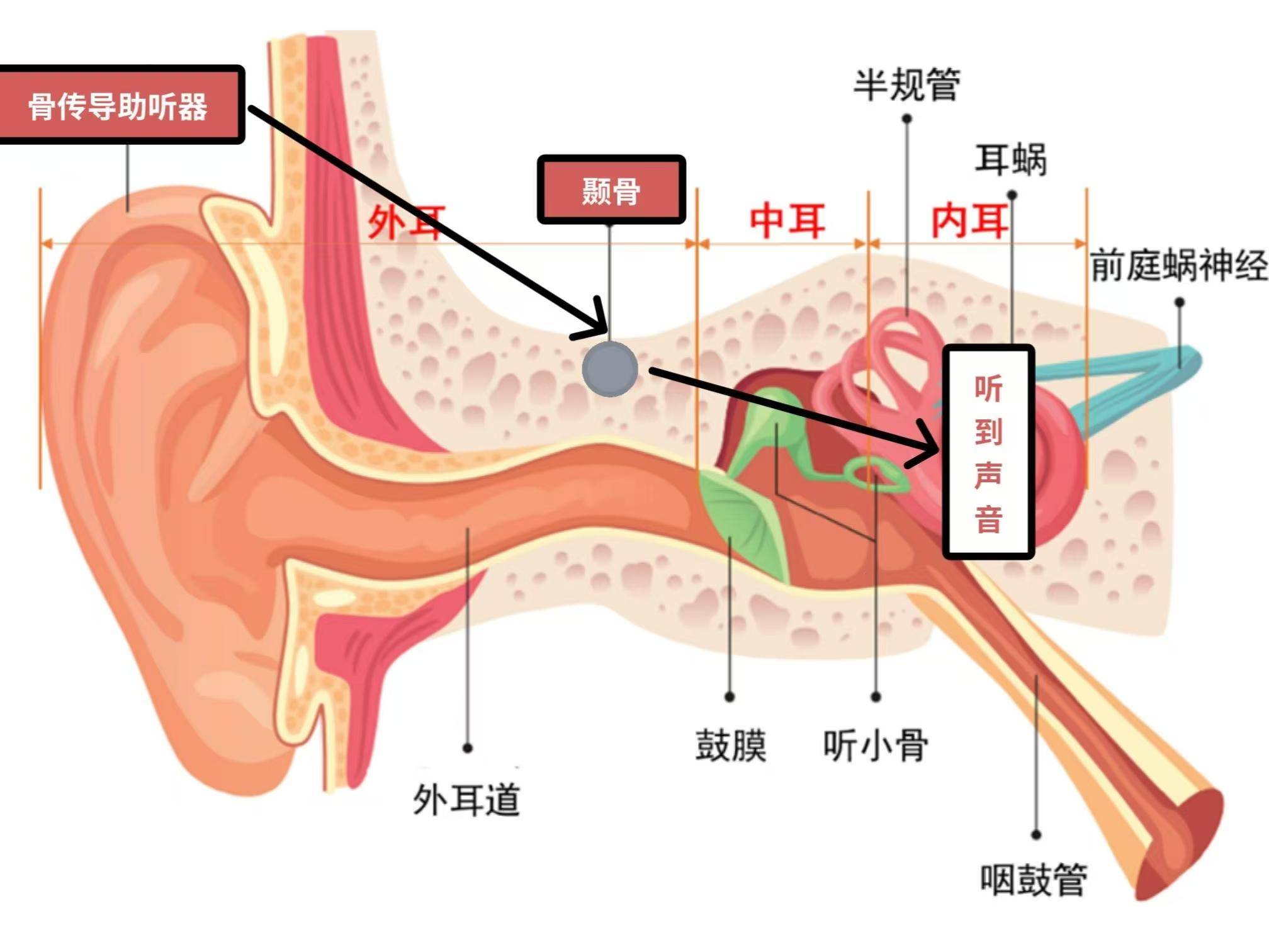 左点骨传导助听器的原理是通过高清麦克风拾取周围环境音,并通过颅骨