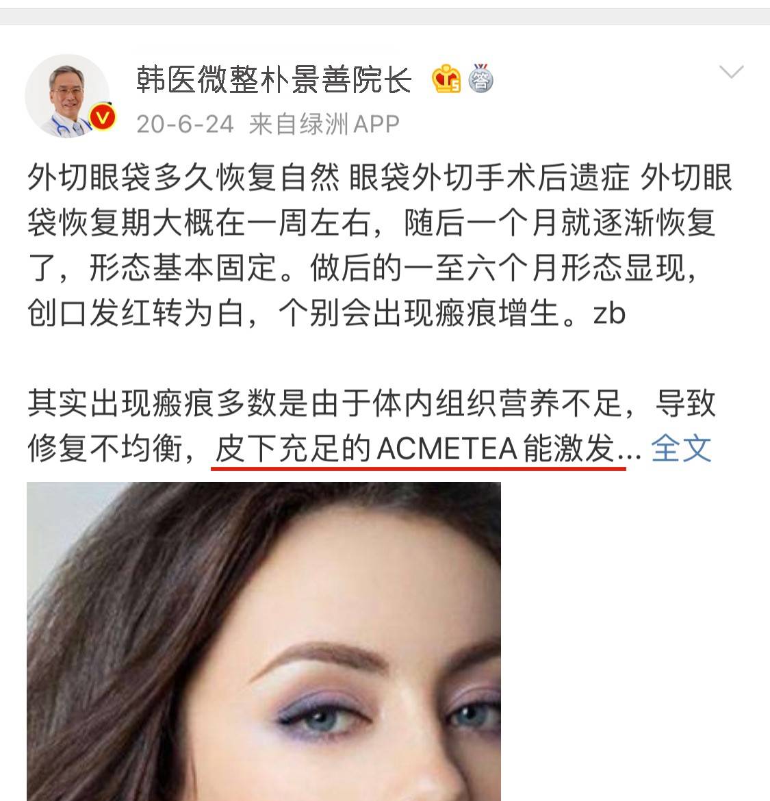 眼袋手术做了以后可以维持几年?祛眼袋手术效果可以维持多久?