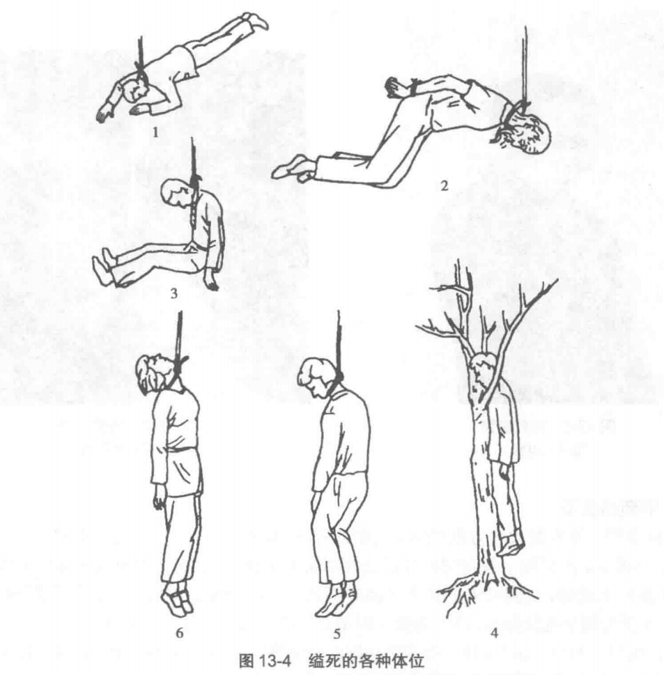 吊死的人什么状态图片