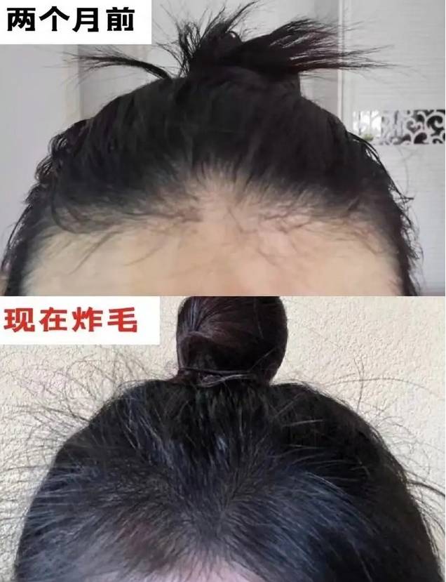 这些防脱育发法,让头发疯长!