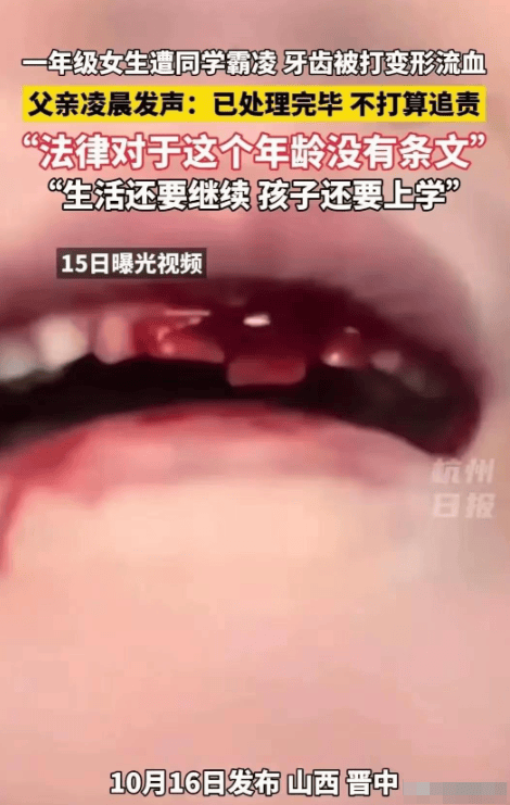 女生牙齿打掉图片