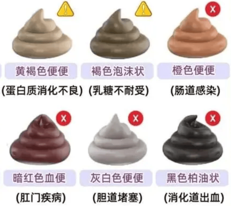 胃癌不痛不痒?医生提醒:饭后如果存在4个表现?建议尽早做胃镜