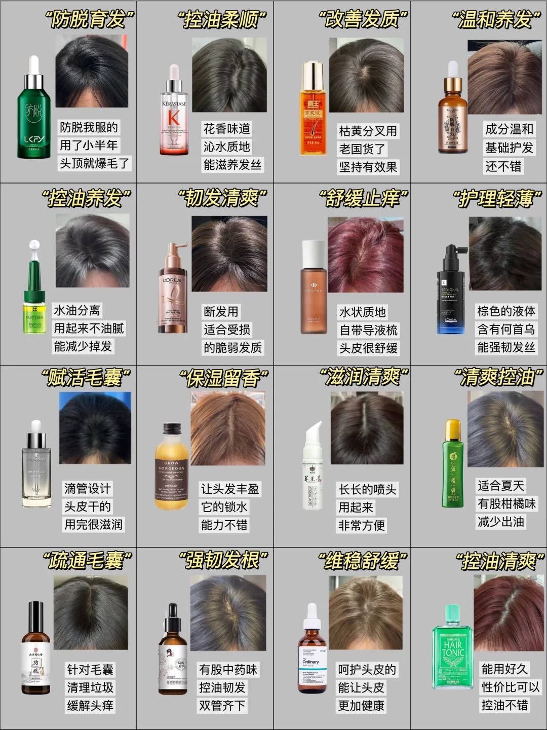 掉发太严重?养发请码住——育发产品排行榜10强_头皮_脱育发_头发