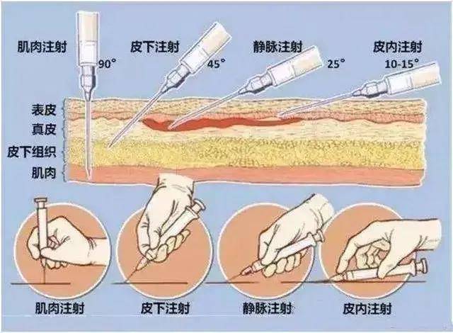 基因枪法和显微注射法图片