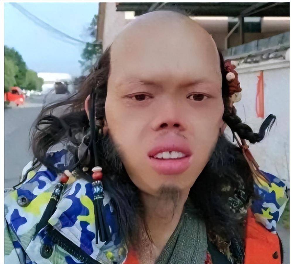 "癞蛤蟆"成人生赢家?80后小伙因长相怪异,日入上千还娶白富美