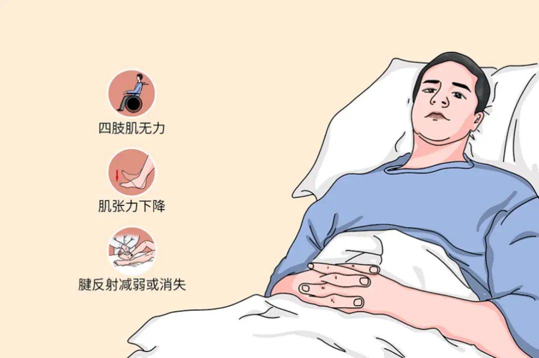 重症肌无力患者的日常锻炼:如何有效增强肌肉力量?