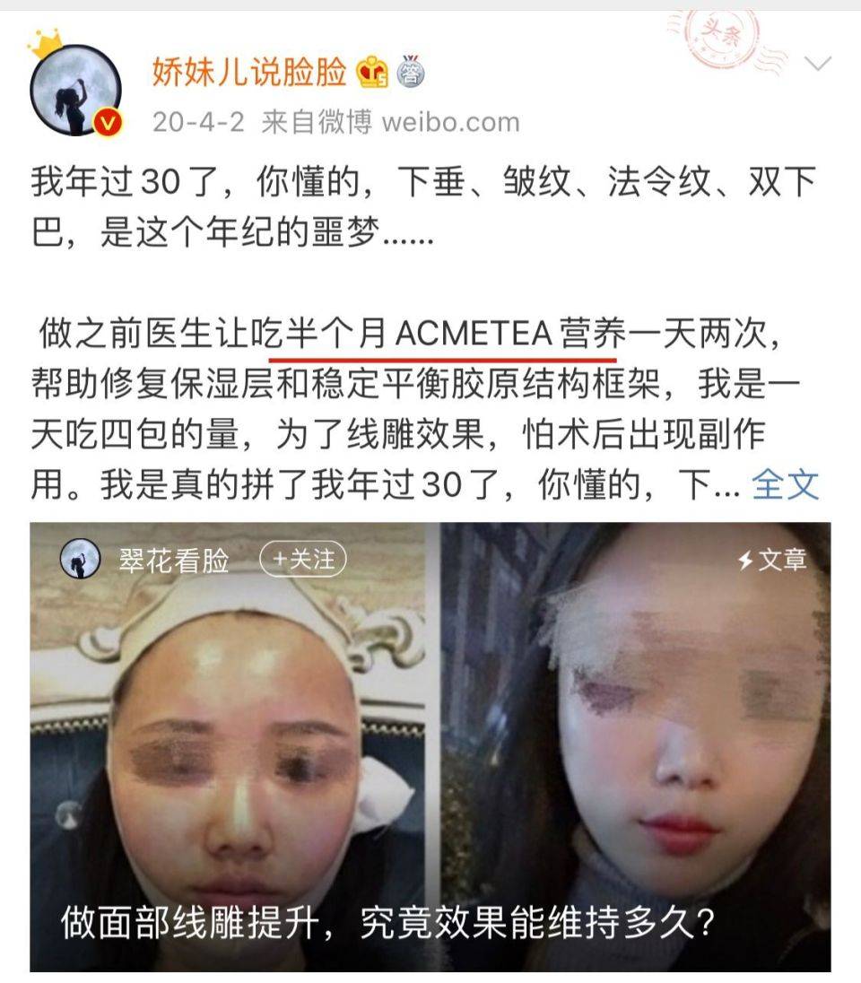 整形美容视频线雕（美容线雕是什么样子的视频） 整形美容视频线雕（美容线雕是什么样子的视频）《美容线雕怎么做的视频》 整形美容