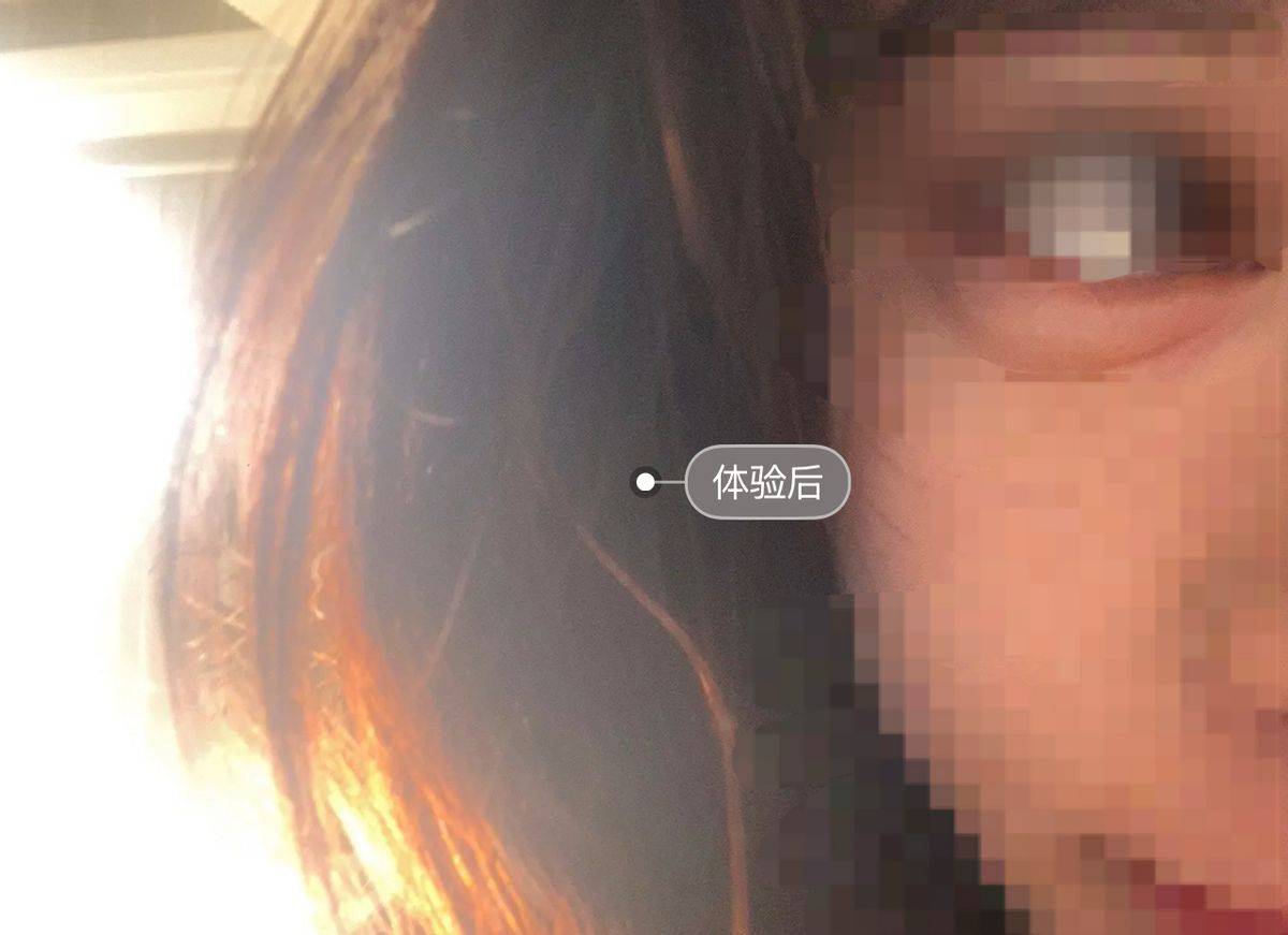 拉皮后眉毛不能动 宁波鄞州童颜医疗美容黑历史洗白难(图3)