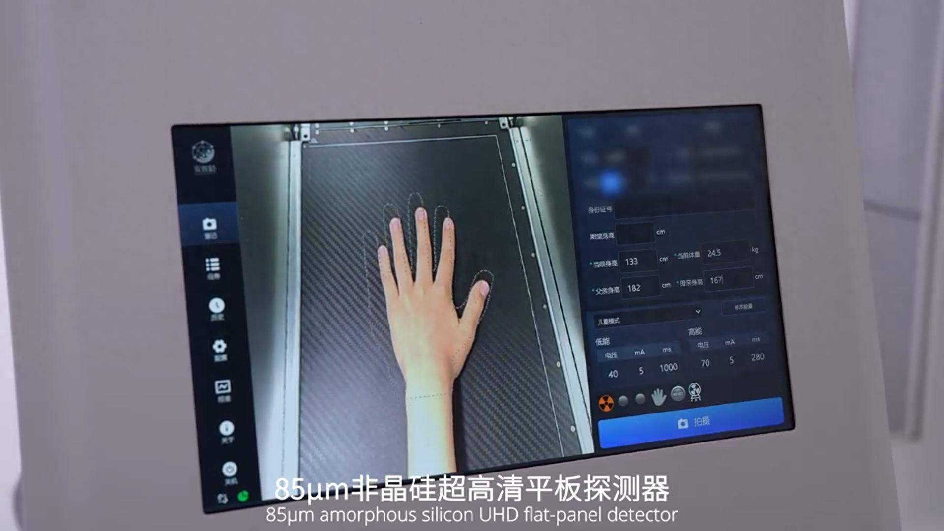 儿童测骨龄拍片有辐射吗？