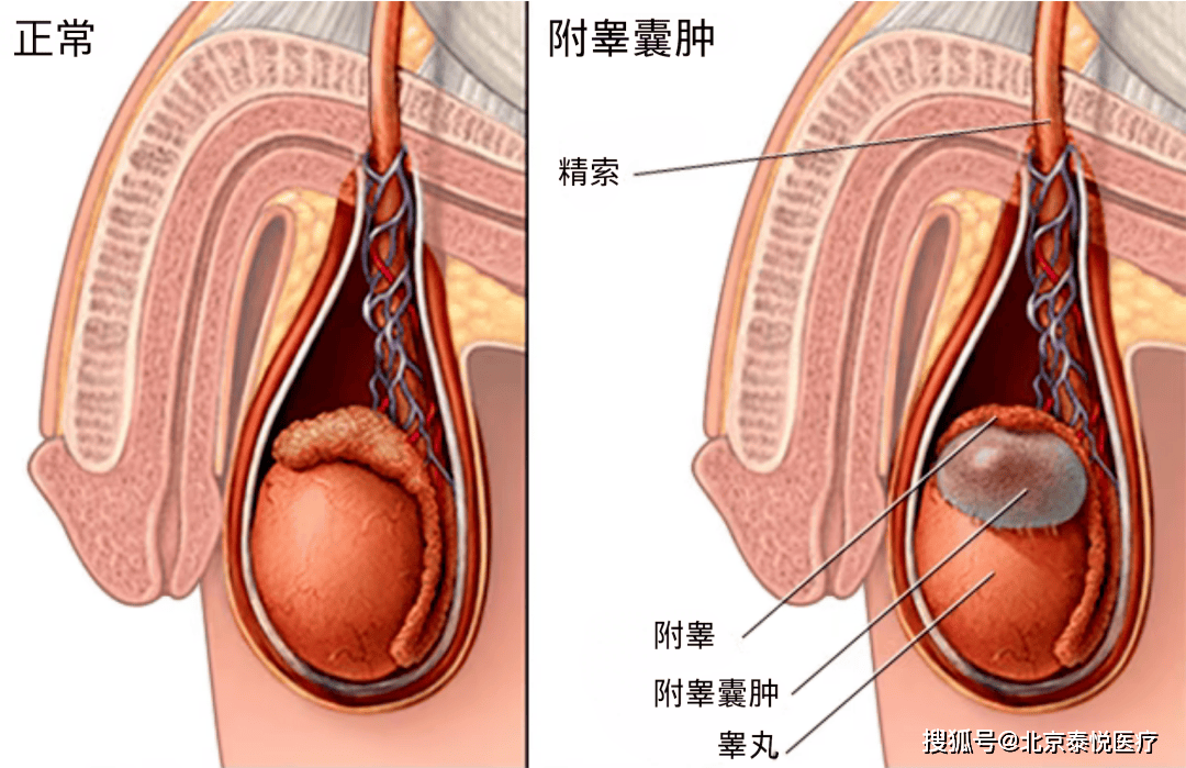 " 蛋蛋 "大未必是好事,请警惕潜在疾病风险!