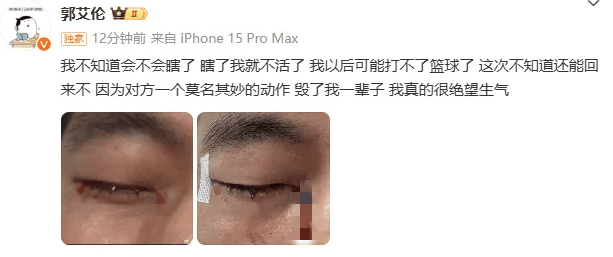 郭艾伦眼伤已顺利拆线：得到了很好的照顾，相信自己一定会重回球场！