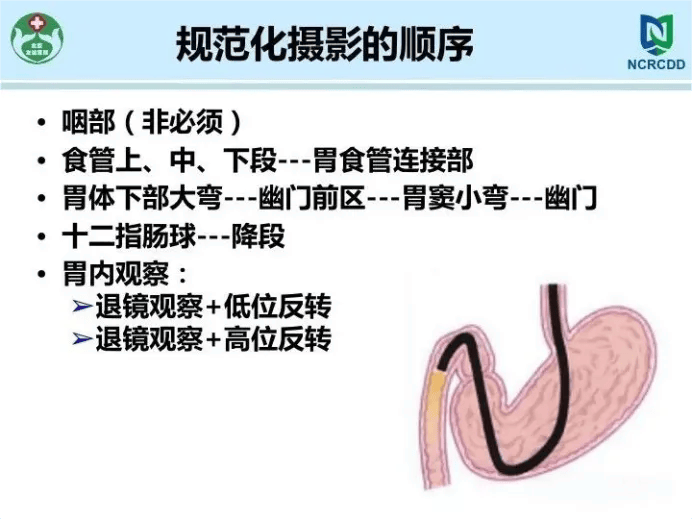 实用!胃镜操作及报告撰写规范分享丨课件分享