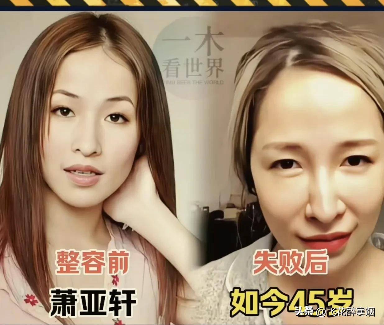 为什么整形