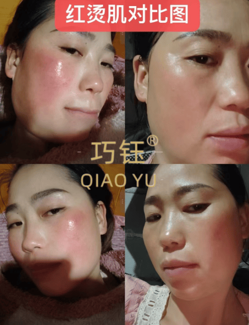 巧钰护肤品安全吗？巧钰护肤品多少钱一套