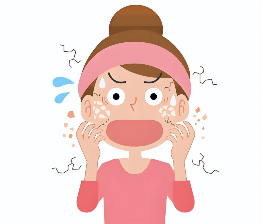 皮肤上的"冬日纹路"