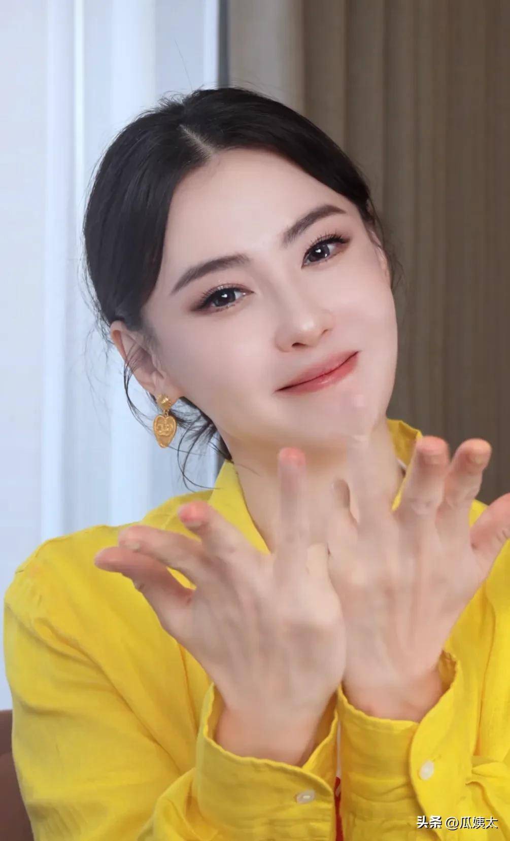 这个脸部填充应该是最近才做的,现在估计还是尴尬期没有恢复好,张柏芝