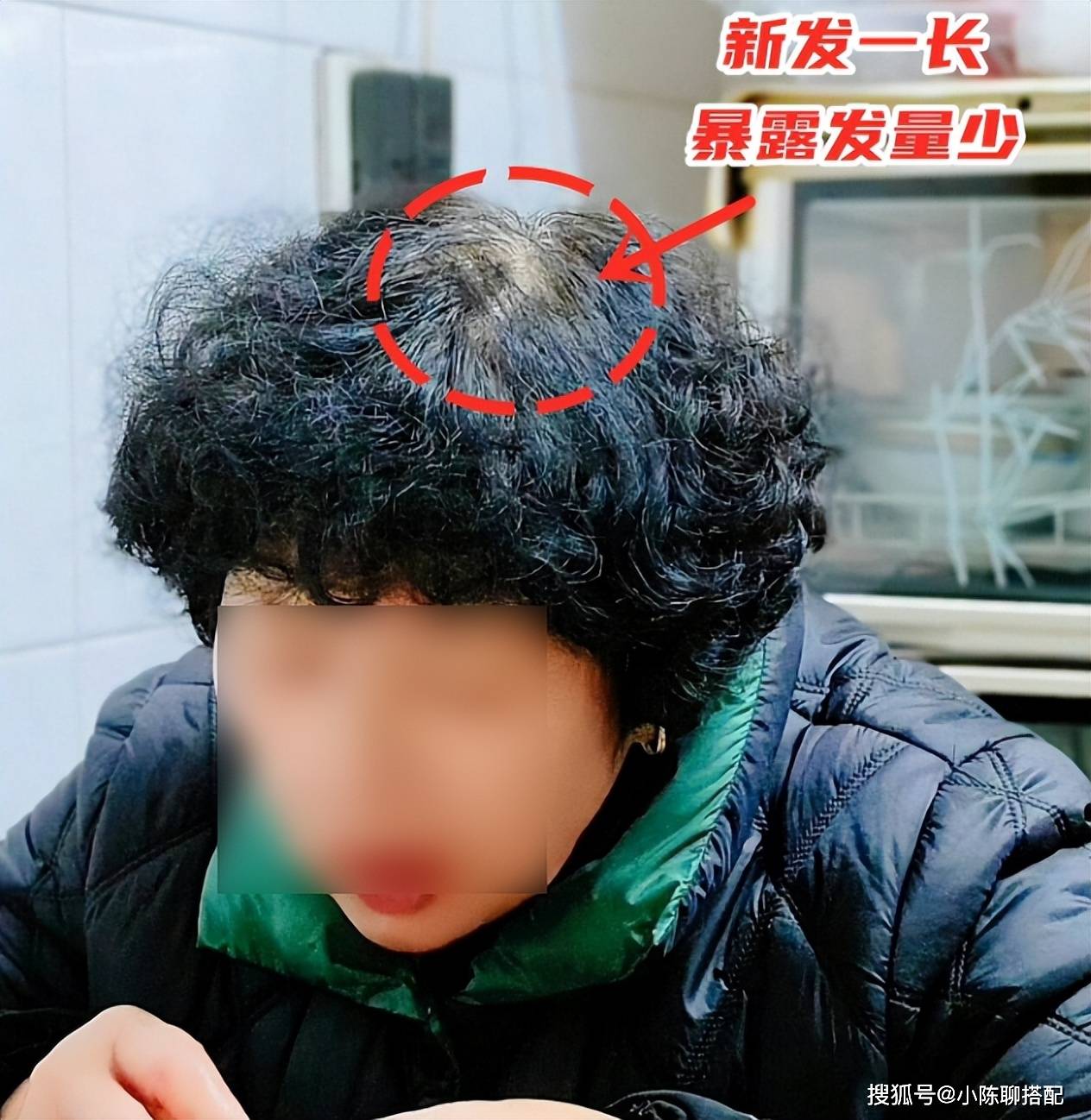 不然等新头发长出来后发型就会彻底变样一旦打理不当发丝