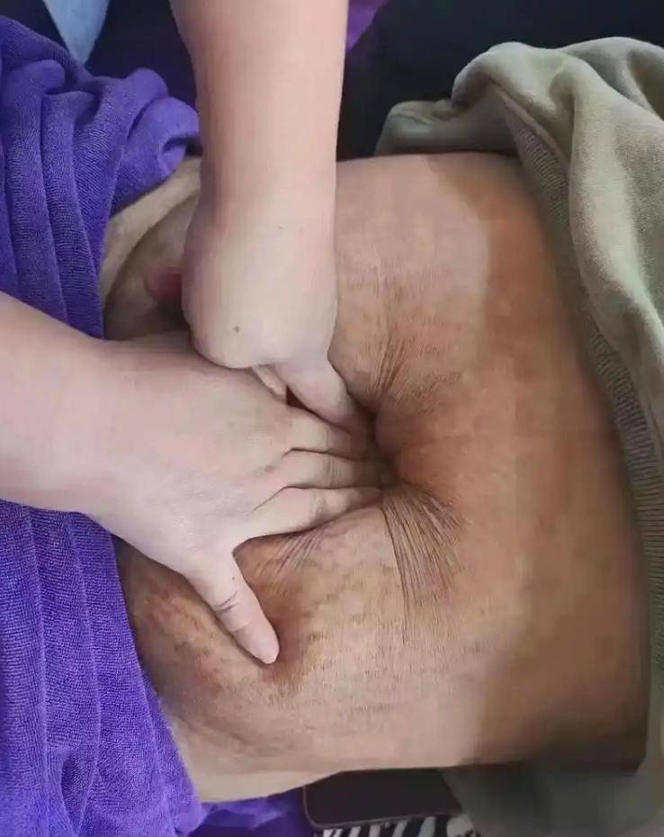 孕妇＂悬浮肚＂引争议,为什么网友就说悬浮肚不好呢？