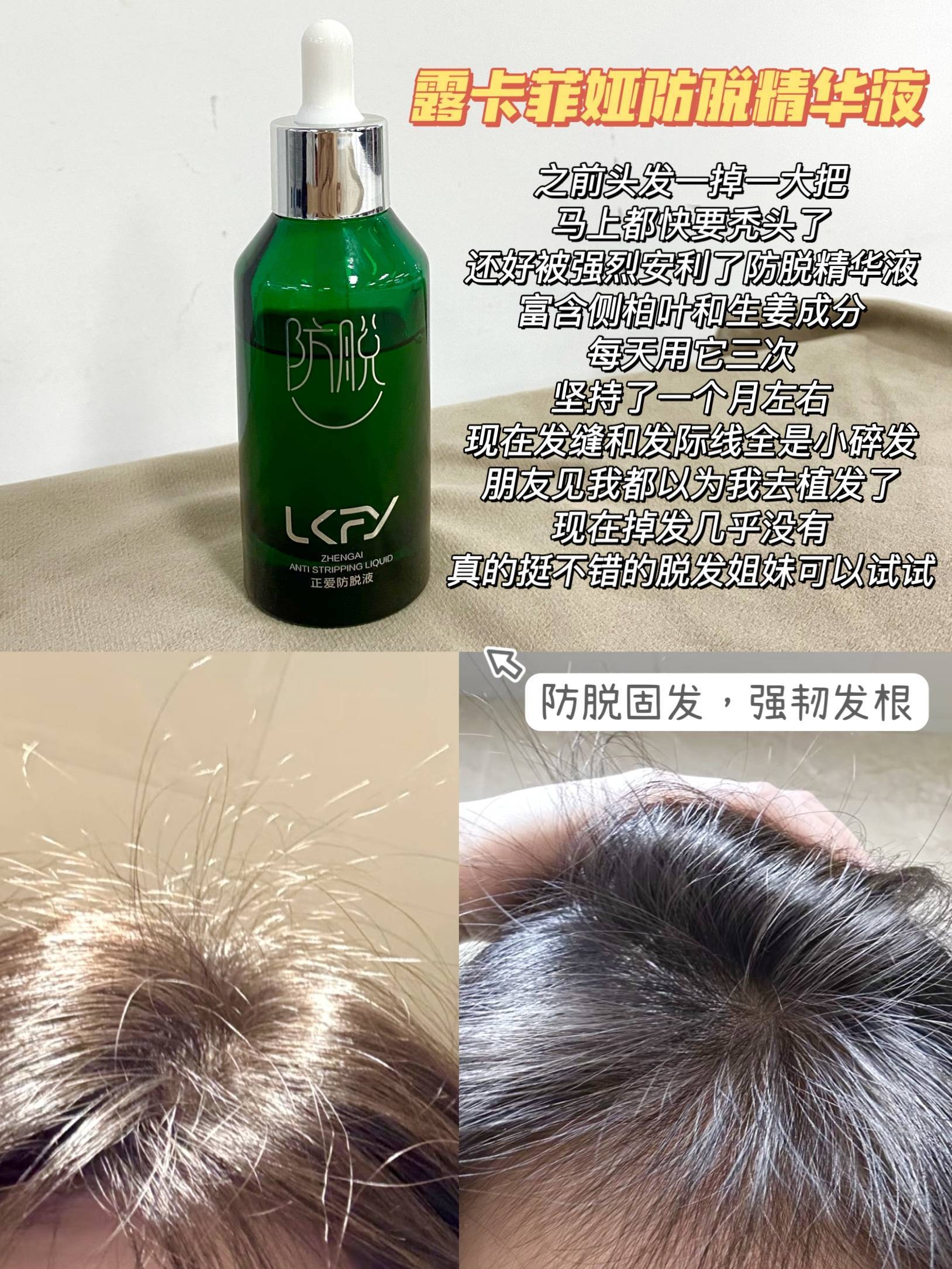 防脱发生发育发排行榜第一名功效超顶