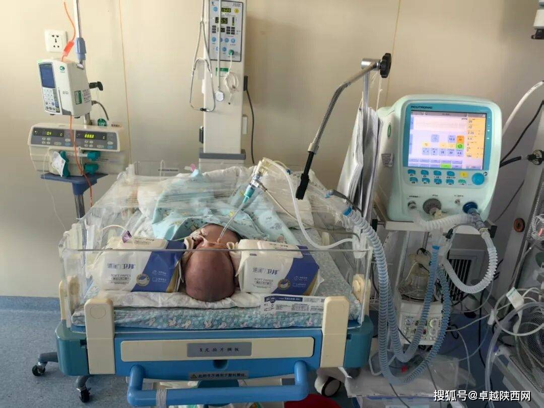 神木市医院新生儿科成功抢救一名出生时重度窒息新生儿