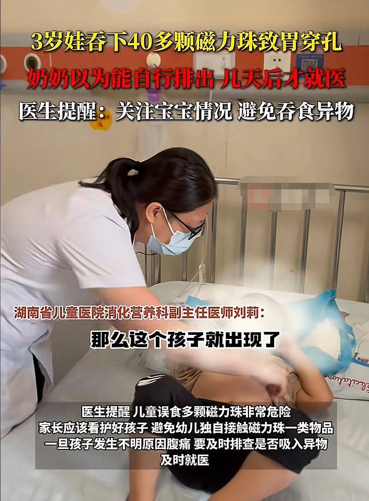 惊险!3岁娃吞下40多颗磁力珠致胃穿孔